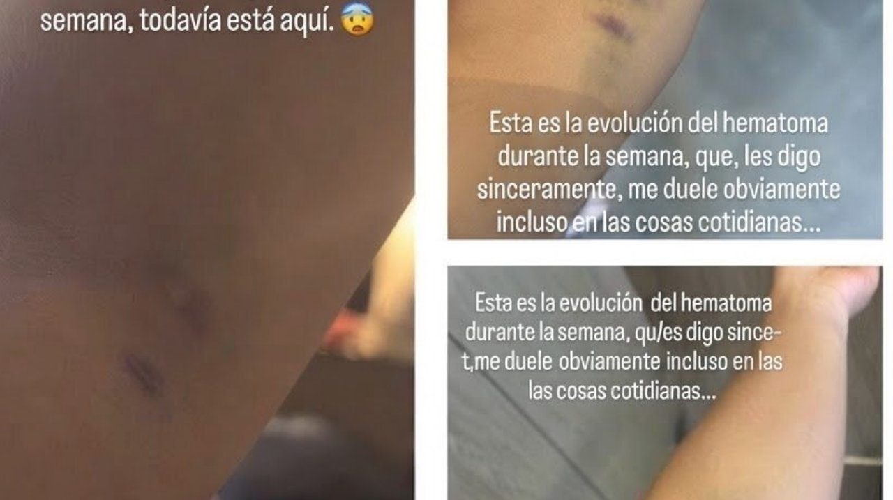 曼联VS布莱顿直播_曼联VS布莱顿免费直播在线直播_曼联VS布莱顿直播高清免费观看